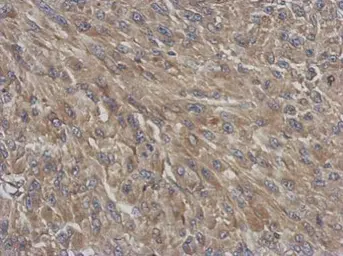 Anti-DYNC1I1 antibody [N3C2], Internal used in IHC (Paraffin sections) (IHC-P). GTX112355