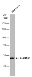 Anti-GLUD1 + GLUD2 antibody used in Western Blot (WB). GTX112361