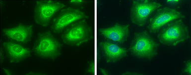 Anti-ATP citrate lyase antibody [C2C3], C-term used in Immunocytochemistry/ Immunofluorescence (ICC/IF). GTX112379