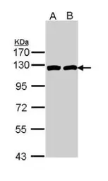 Anti-ATP citrate lyase antibody [C2C3], C-term used in Western Blot (WB). GTX112379