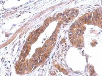 Anti-alanyl-tRNA synthetase antibody [N1N2], N-term used in IHC (Paraffin sections) (IHC-P). GTX112386