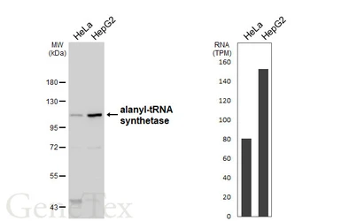 Anti-alanyl-tRNA synthetase antibody [N1N2], N-term used in Western Blot (WB). GTX112386
