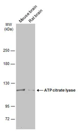 Anti-ATP citrate lyase antibody [N1N2], N-term used in Western Blot (WB). GTX112387