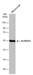 Anti-ALDH3A1 antibody [N1C2] used in Western Blot (WB). GTX112391