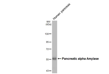 Anti-Pancreatic alpha Amylase antibody [N3C3] used in Western Blot (WB). GTX112396