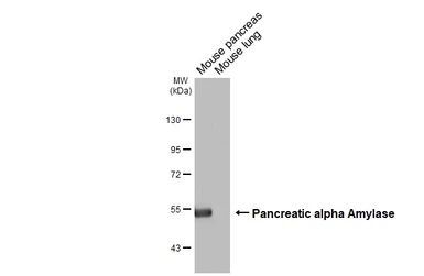 Anti-Pancreatic alpha Amylase antibody [N3C3] used in Western Blot (WB). GTX112396
