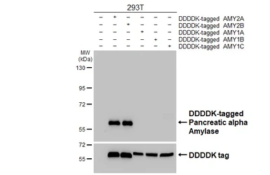 Anti-Pancreatic alpha Amylase antibody [N3C3] used in Western Blot (WB). GTX112396