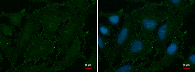 Anti-AOC2 antibody used in Immunocytochemistry/ Immunofluorescence (ICC/IF). GTX112397