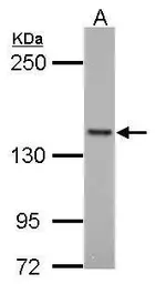Anti-FMNL1 antibody [C1C2], Internal used in Western Blot (WB). GTX112404
