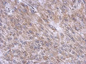Anti-DYNC1I1 antibody used in IHC (Paraffin sections) (IHC-P). GTX112418