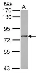 Anti-GNL1 antibody [N1C1] used in Western Blot (WB). GTX112433