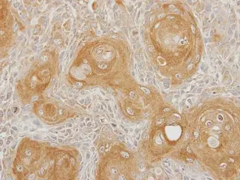 Anti-INPP5B antibody [C2C3], C-term used in IHC (Paraffin sections) (IHC-P). GTX112444