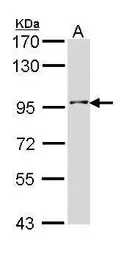 Anti-INPP5B antibody [C2C3], C-term used in Western Blot (WB). GTX112444