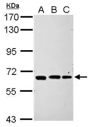 Anti-IPP antibody [N2C2], Internal used in Western Blot (WB). GTX112445