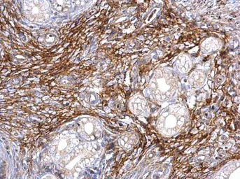 Anti-ITIH3 antibody [N1N3] used in IHC (Paraffin sections) (IHC-P). GTX112448