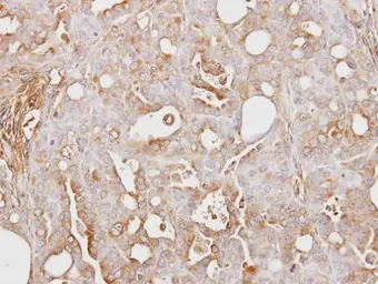Anti-ITIH3 antibody [N1N3] used in IHC (Paraffin sections) (IHC-P). GTX112448