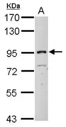 Anti-ITIH3 antibody [N1N3] used in Western Blot (WB). GTX112448
