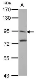 Anti-ITIH3 antibody [N1N3] used in Western Blot (WB). GTX112448
