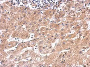 Anti-alanyl-tRNA synthetase antibody [N3C2], Internal used in IHC (Paraffin sections) (IHC-P). GTX112477