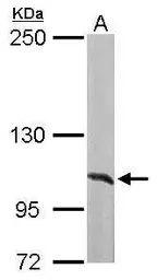Anti-alanyl-tRNA synthetase antibody [N3C2], Internal used in Western Blot (WB). GTX112477