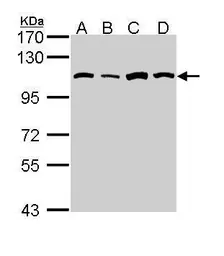 Anti-alanyl-tRNA synthetase antibody [N3C2], Internal used in Western Blot (WB). GTX112477