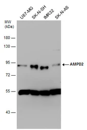 Anti-AMPD2 antibody [N3C3] used in Western Blot (WB). GTX112483