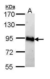 Anti-AMPD2 antibody [N3C3] used in Western Blot (WB). GTX112483