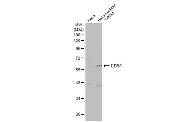 Anti-CDS1 antibody [C1C3] used in Western Blot (WB). GTX112491