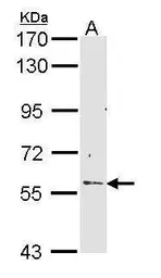 Anti-RCBTB2 antibody [N3C3] used in Western Blot (WB). GTX112492