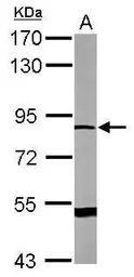 Anti-DRP2 antibody [N3C1], Internal used in Western Blot (WB). GTX112512