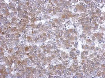 Anti-Hemopexin antibody used in IHC (Paraffin sections) (IHC-P). GTX112519