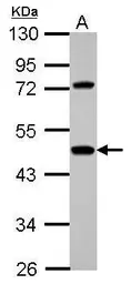 Anti-Hemopexin antibody used in Western Blot (WB). GTX112519