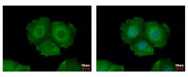 Anti-Cytokeratin 31 antibody [N3C3] used in Immunocytochemistry/ Immunofluorescence (ICC/IF). GTX112529