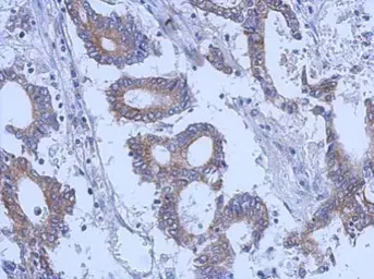 Anti-Cytokeratin 31 antibody [N3C3] used in IHC (Paraffin sections) (IHC-P). GTX112529