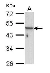 Anti-Cytokeratin 33B antibody [N1C1] used in Western Blot (WB). GTX112531