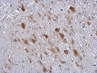 Anti-Kinectin 1 antibody [C2C3], C-term used in IHC (Paraffin sections) (IHC-P). GTX112532
