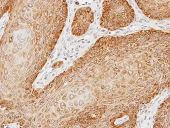 Anti-Kinectin 1 antibody [C2C3], C-term used in IHC (Paraffin sections) (IHC-P). GTX112532