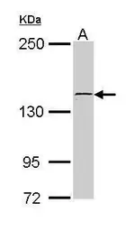 Anti-Kinectin 1 antibody [C2C3], C-term used in Western Blot (WB). GTX112532