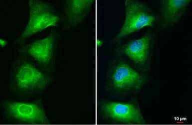 Anti-MAT1A + MAT2A antibody [N1C2] used in Immunocytochemistry/ Immunofluorescence (ICC/IF). GTX112535