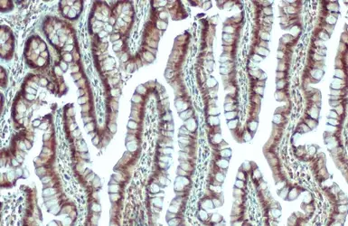 Anti-MAT1A + MAT2A antibody [N1C2] used in IHC (Paraffin sections) (IHC-P). GTX112535