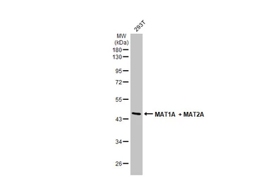 Anti-MAT1A + MAT2A antibody [N1C2] used in Western Blot (WB). GTX112535