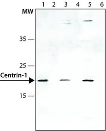 Anti-Centrin 1 antibody used in Western Blot (WB). GTX11257