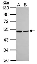 Anti-beta Lactamase antibody [N1C1] used in Western Blot (WB). GTX112574