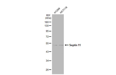 Anti-Septin 11 antibody used in Western Blot (WB). GTX112576
