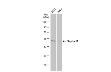 Anti-Septin 11 antibody used in Western Blot (WB). GTX112576