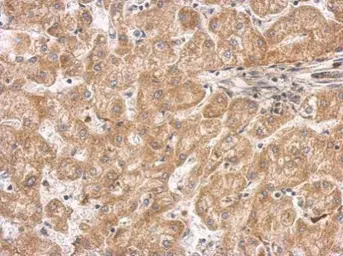 Anti-Septin 11 antibody used in IHC (Paraffin sections) (IHC-P). GTX112576