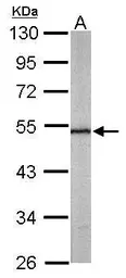 Anti-Septin 11 antibody used in Western Blot (WB). GTX112576