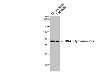 Anti-DNA polymerase iota antibody [N3C2], Internal used in Western Blot (WB). GTX112583