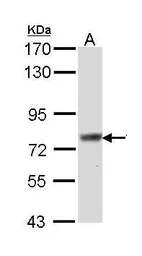 Anti-SCIN antibody [N3C2], Internal used in Western Blot (WB). GTX112591