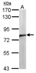Anti-CDC5L antibody [N2C2], Internal used in Western Blot (WB). GTX112603